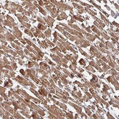 Immunohistochemistry-Paraffin: KIF1C Antibody [NBP2-48824] - Staining of human heart muscle shows strong cytoplasmic positivity in myocytes.