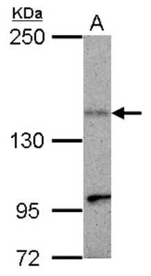 Western Blot: KIF1C Antibody [NBP2-17051] - Sample (30 ug of whole cell lysate) A: HepG2 5% SDS PAGE gel, diluted at 1:500.