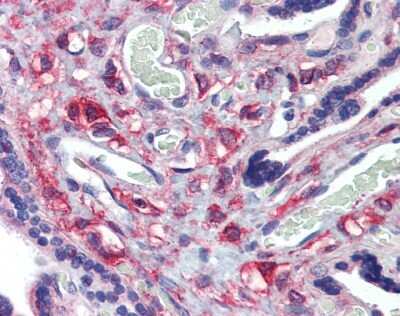 Immunohistochemistry KIF20A Antibody