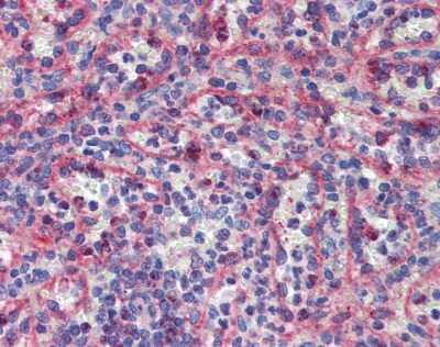 Immunohistochemistry KIF20A Antibody