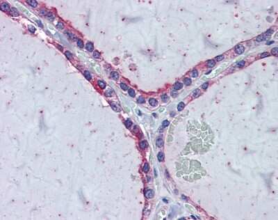 Immunohistochemistry KIF20A Antibody