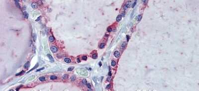 Immunohistochemistry: KIF20A Antibody [NBP2-87689] - Immunohistochemistry with Human Thyroid lysate tissue at an antibody concentration of 5.0ug/ml using anti-KIF20A antibody