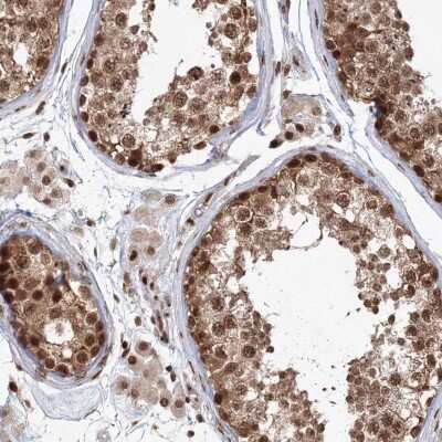 Immunohistochemistry-Paraffin: KIF20A Antibody [NBP1-87176] - Staining of human testis shows nuclear and cytoplasmic positivity in cells in seminiferous ducts.