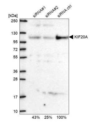 Western Blot: KIF20A Antibody [NBP1-87176] - Analysis in U2OS cells transfected with control siRNA, target specific siRNA probe #1 and #2. Remaining relative intensity is presented.