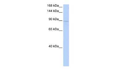 Western Blot: KIF20A Antibody [NBP2-87689] - KIF20A antibody - middle region validated by WB using 721_B Cell Lysate at 1ug/ml. KIF20A is supported by BioGPS gene expression data to be expressed in 721_B