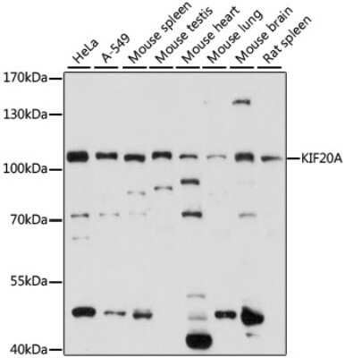 Western Blot: KIF20A Antibody [NBP3-05117] - Analysis of extracts of various cell lines, using KIF20A antibody at 1:1000 dilution. Secondary antibody: HRP Goat Anti-Rabbit IgG (H+L) at 1:10000 dilution. Lysates/proteins: 25ug per lane. Blocking buffer: 3% nonfat dry milk in TBST. Detection: ECL Basic Kit