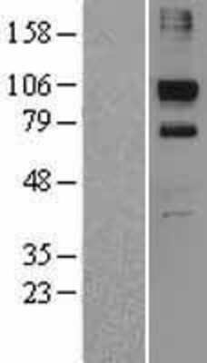 Western Blot: KIF20A Overexpression Lysate (Adult Normal) [NBL1-12291] Left-Empty vector transfected control cell lysate (HEK293 cell lysate); Right -Over-expression Lysate for KIF20A.