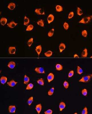 Immunocytochemistry/Immunofluorescence: KIF21A Antibody [NBP3-04389] - Analysis of L929 cells using KIF21A Rabbit pAb at dilution of 1:100. Blue: DAPI for nuclear staining.