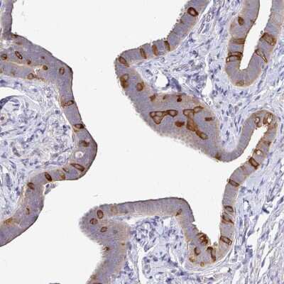 Immunohistochemistry-Paraffin: KIF21A Antibody [NBP2-37969] - Staining of human fallopian tube shows strong cytoplasmic and moderate luminal membranous positivity in a subset of glandular cells.