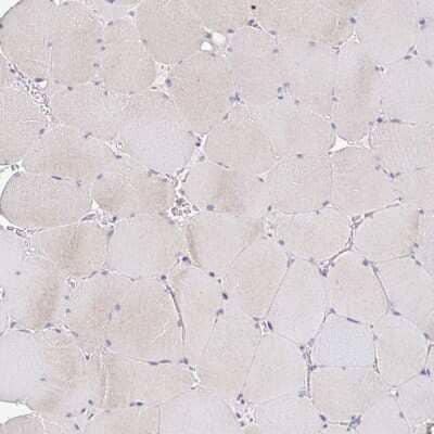 Immunohistochemistry-Paraffin: KIF21A Antibody [NBP2-37969] - Staining of human skeletal muscle shows weak positivity in myocytes.