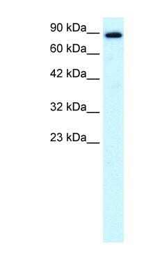 Western Blot: KIF21A Antibody [NBP1-58143] - Human Brain lysate, concentration 0.2-1 ug/ml.