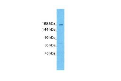 Western Blot: KIF21A Antibody [NBP1-58143] - Antibody  Titration: 0.2-1 ug/ml Positive control: MCF7.