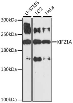 Western Blot: KIF21A Antibody [NBP3-04389] - Analysis of extracts of various cell lines, using KIF21A antibody at 1:1000 dilution. Secondary antibody: HRP Goat Anti-Rabbit IgG (H+L) at 1:10000 dilution. Lysates/proteins: 25ug per lane. Blocking buffer: 3% nonfat dry milk in TBST. Detection: ECL Basi