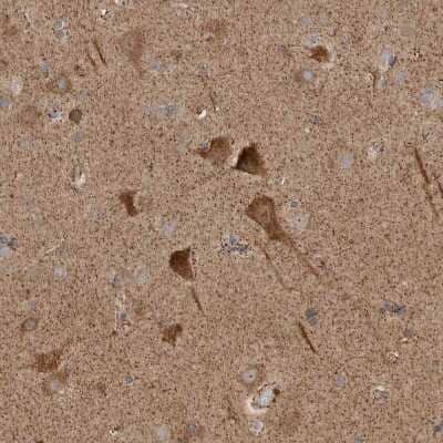 Immunohistochemistry-Paraffin KIF21B Antibody