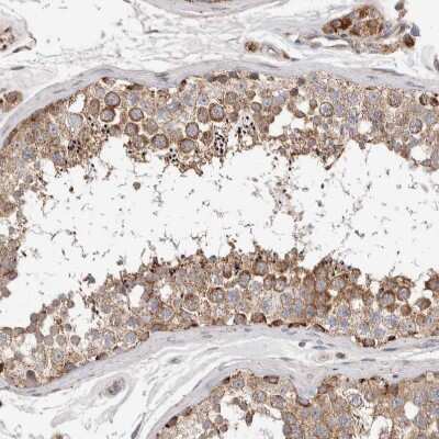 Immunohistochemistry-Paraffin KIF21B Antibody