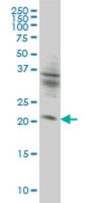 Western Blot: KIF26A Antibody (3C10) [H00026153-M01] - KIF26A monoclonal antibody (M01), clone 3C10 Analysis of KIF26A expression in HeLa.