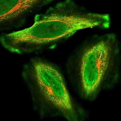 Immunocytochemistry/Immunofluorescence: KIF26A Antibody [NBP2-14158] - Immunofluorescent staining of human cell line HeLa shows localization to nucleoplasm & plasma membrane.