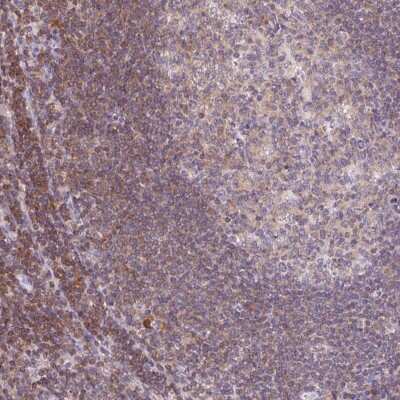 Immunohistochemistry: KIF26A Antibody [NBP2-38891] - Staining of human lymph node shows moderate cytoplasmic positivity in non-germinal center cells.
