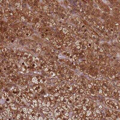 Immunohistochemistry-Paraffin: KIF26A Antibody [NBP2-14158] - Staining of human adrenal gland shows strong cytoplasmic and nuclear positivity in glandular cells.