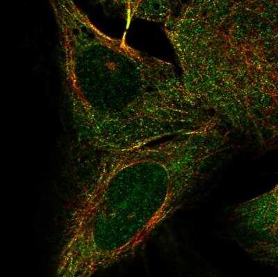 Immunocytochemistry/Immunofluorescence: KIF2B Antibody [NBP1-89446] - Staining of human cell line U-2 OS shows localization to nucleoli, microtubules, cytokinetic bridge & mitotic spindle. Antibody staining is shown in green.