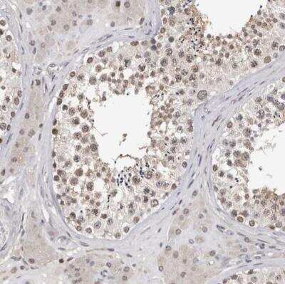 Immunohistochemistry-Paraffin: KIF2B Antibody [NBP1-86002] - Staining of human testis shows moderate nuclear and cytoplasmic positivity in seminiferous ducts.