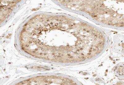 Immunohistochemistry-Paraffin: KIF2B Antibody [NBP1-86416] - Staining of human testis shows moderate cytoplasmic and nuclear postivity in seminiferous ducts.