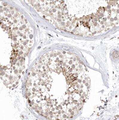 Immunohistochemistry-Paraffin: KIF2B Antibody [NBP1-89446] - Staining of human testis shows moderate cytoplasmic positivity in seminiferous ducts.