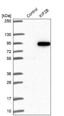 Western Blot: KIF2B Antibody [NBP1-89446] - Analysis in control (vector only transfected HEK293T lysate) and KIF2B over-expression lysate (Co-expressed with a C-terminal myc-DDK tag (3.1 kDa) in mammalian HEK293T cells).