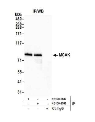 <b>Independent Antibodies Validation. </b>Immunoprecipitation: KIF2C Antibody [NB100-2588] - Detection of human MCAK by western blot of immunoprecipitates. Samples: Whole cell lysate (1.0 mg per IP reaction; 20% of IP loaded) from HeLa cells prepared using NETN lysis buffer. Antibodies: Affinity purified rabbit anti-MCAK antibody NB100-2588 used for IP at 3 ug per reaction. MCAK was also immunoprecipitated by rabbit anti-MCAK antibody NB100-2587. For blotting immunoprecipitated MCAK, NB100-2588 was used at 1 ug/ml. Detection: Chemiluminescence with an exposure time of 10 seconds.