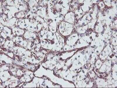 Immunohistochemistry: KIF2C Antibody (OTI1C5) - Azide and BSA Free [NBP2-71667] - Staining of paraffin-embedded Carcinoma of Human kidney tissue using anti-KIF2C mouse monoclonal antibody.