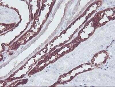 Immunohistochemistry: KIF2C Antibody (OTI1C5) - Azide and BSA Free [NBP2-71667] - Staining of paraffin-embedded Human Kidney tissue using anti-KIF2C mouse monoclonal antibody.