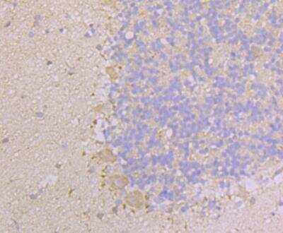 Immunohistochemistry: KIF3A Antibody [NBP2-76942] - Immunohistochemical analysis of paraffin-embedded rat cerebellum tissue using anti-KIF3A antibody. Counter stained with hematoxylin.
