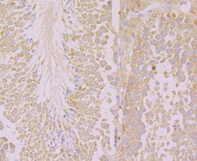 Immunohistochemistry: KIF3A Antibody [NBP2-76942] - Immunohistochemical analysis of paraffin-embedded mouse testis tissue using anti-KIF3A antibody. Counter stained with hematoxylin.