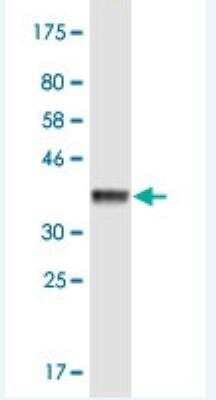 Western Blot KIF3B Antibody (8H4)