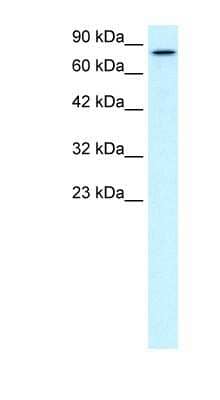 Western Blot: KIF3B Antibody [NBP1-58138] - HepG2 cell lysate, concentration 0.2-1 ug/ml.