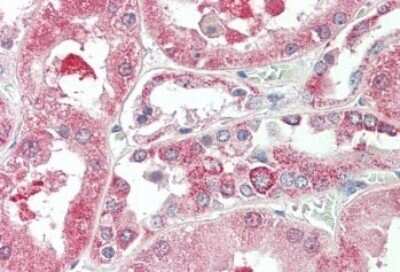 Immunohistochemistry-Paraffin KIF6 Antibody