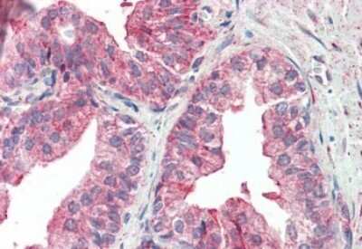 Immunohistochemistry-Paraffin KIF6 Antibody