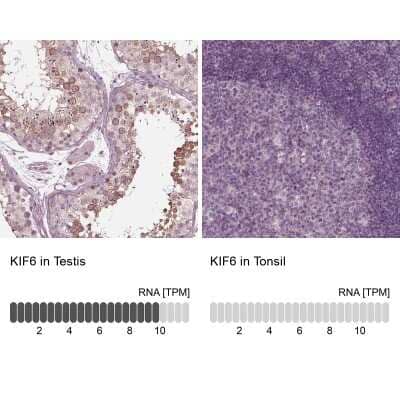 <b>Orthogonal Strategies Validation. </b>Immunohistochemistry-Paraffin: KIF6 Antibody [NBP1-86767] - Staining in human testis and tonsil tissues using anti-KIF6 antibody. Corresponding KIF6 RNA-seq data are presented for the same tissues.