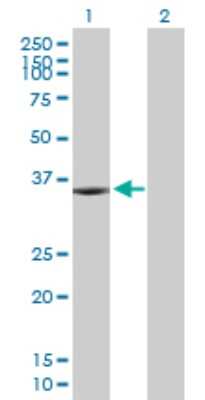 Western Blot: KIF6 Antibody [H00221458-B01P] - Analysis of KIF6 expression in transfected 293T cell line by KIF6 polyclonal antibody.  Lane 1: KIF6 transfected lysate(32.23 KDa). Lane 2: Non-transfected lysate.