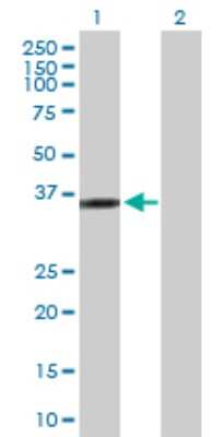 Western Blot: KIF6 Antibody [H00221458-D01P] - Analysis of KIF6 expression in transfected 293T cell line by KIF6 polyclonal antibody.Lane 1: KIF6 transfected lysate(33.10 KDa).Lane 2: Non-transfected lysate.