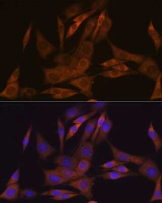 Immunocytochemistry/Immunofluorescence: KIFAP3 Antibody (1S7J7) [NBP3-16592] - Immunofluorescence analysis of NIH-3T3 cells using KIFAP3 Rabbit mAb (NBP3-16592) at dilution of 1:100 (40x lens). Blue: DAPI for nuclear staining.