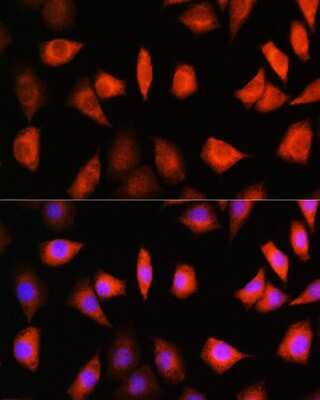 Immunocytochemistry/Immunofluorescence: KIFAP3 Antibody [NBP3-04508] - Immunofluorescence analysis of L929 cells using KIFAP3 Rabbit pAb (NBP3-04508) at dilution of 1:100. Blue: DAPI for nuclear staining.