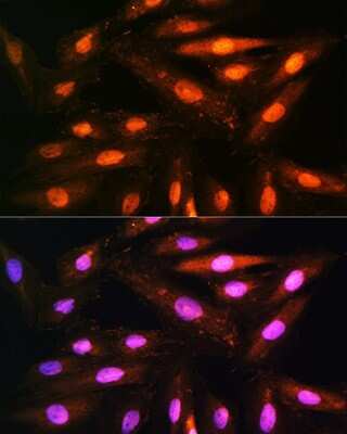 Immunocytochemistry/Immunofluorescence: KIFAP3 Antibody [NBP3-04508] - Immunofluorescence analysis of H9C2 cells using KIFAP3 Rabbit pAb (NBP3-04508) at dilution of 1:100. Blue: DAPI for nuclear staining.