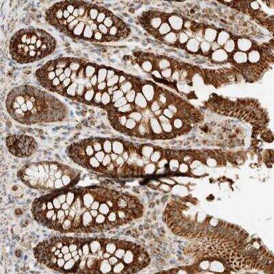 Immunohistochemistry-Paraffin: KIFAP3 Antibody [NBP1-81568] - Staining of human colon shows strong cytoplasmic positivity in glandular cells.