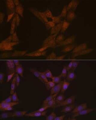 Immunocytochemistry/Immunofluorescence: KIFC1 Antibody (10M10J4) [NBP3-15248] - Immunofluorescence analysis of NIH-3T3 cells using KIFC1 Rabbit mAb (NBP3-15248) at dilution of 1:100 (40x lens). Blue: DAPI for nuclear staining.