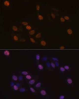 Immunocytochemistry/Immunofluorescence: KIFC1 Antibody (10M10J4) [NBP3-15248] - Immunofluorescence analysis of U-2 OS cells using KIFC1 Rabbit mAb (NBP3-15248) at dilution of 1:100 (40x lens). Blue: DAPI for nuclear staining.