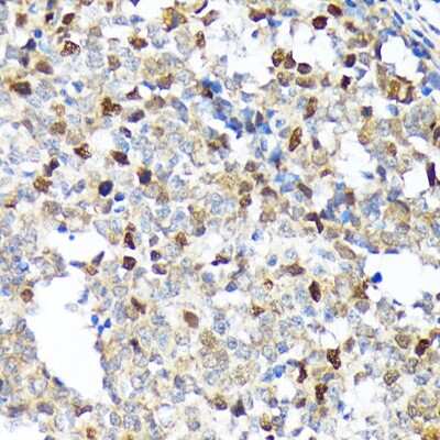 Immunohistochemistry-Paraffin: KIFC1 Antibody (10M10J4) [NBP3-15248] - Immunohistochemistry of paraffin-embedded human appendix using KIFC1 Rabbit mAb (NBP3-15248) at dilution of 1:100 (40x lens).Perform microwave antigen retrieval with 10 mM Tris/EDTA buffer pH 9.0 before commencing with IHC staining protocol.