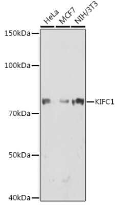 Western Blot: KIFC1 Antibody (10M10J4) [NBP3-15248] - Western blot analysis of extracts of various cell lines, using KIFC1 antibody (NBP3-15248) at 1:1000 dilution. Secondary antibody: HRP Goat Anti-Rabbit IgG (H+L) at 1:10000 dilution. Lysates/proteins: 25ug per lane. Blocking buffer: 3% nonfat dry milk in TBST. Detection: ECL Enhanced Kit. Exposure time: 90s.