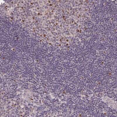 Immunohistochemistry: KIFC1 Antibody [NBP2-49370] - Staining of human tonsil shows nuclear positivity.