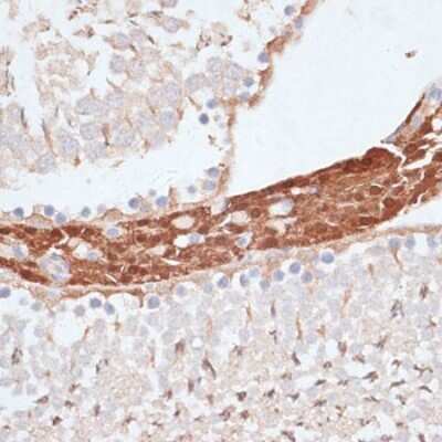 Immunohistochemistry-Paraffin: KIFC1 Antibody [NBP3-04585] - Paraffin-embedded rat testis using KIFC1 antibody at dilution of 1:100 (40x lens).